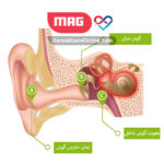 لابیرنتیت یا عفونت گوش داخلی چیست؟ علل و علائم