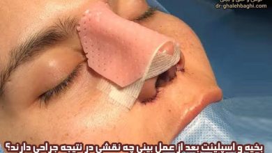 بخیه و اسپلینت بعد از عمل بینی چه نقشی در نتیجه جراحی دارند؟