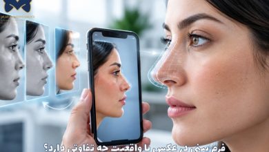 فرم بینی در عکس با واقعیت چه تفاوتی دارد؟