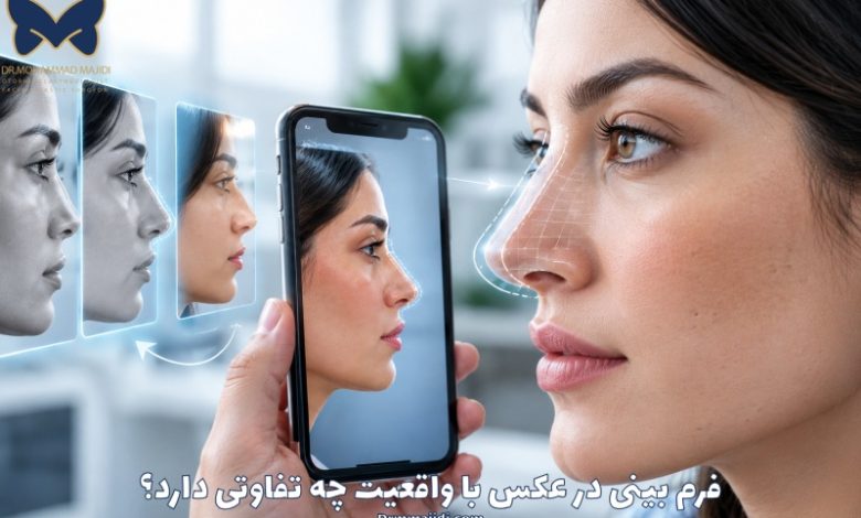 فرم بینی در عکس با واقعیت چه تفاوتی دارد؟