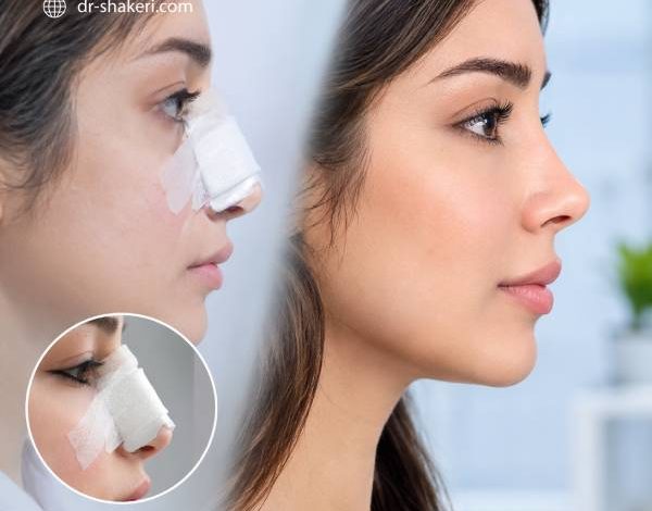 چرا بینی تازه عمل شده، شبیه نتیجه نهایی نیست؟