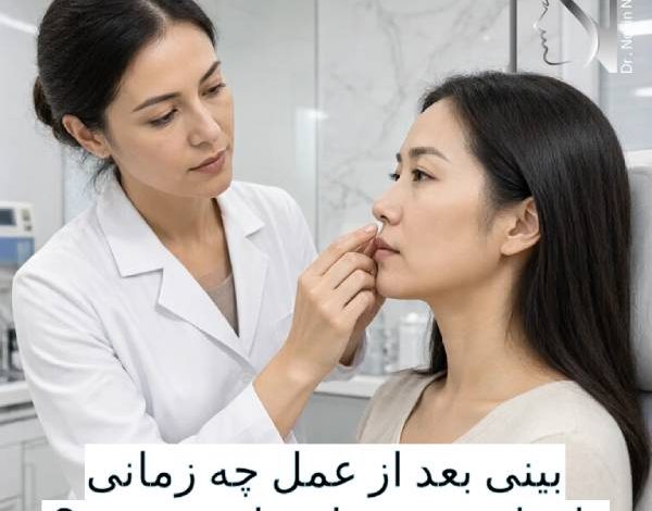 بینی بعد از عمل چه زمانی واقعا خودش را نشان می‌دهد؟